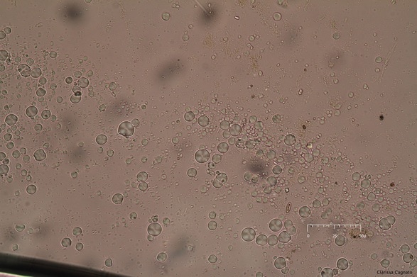 Macal Xanthosoma Starch grain photo